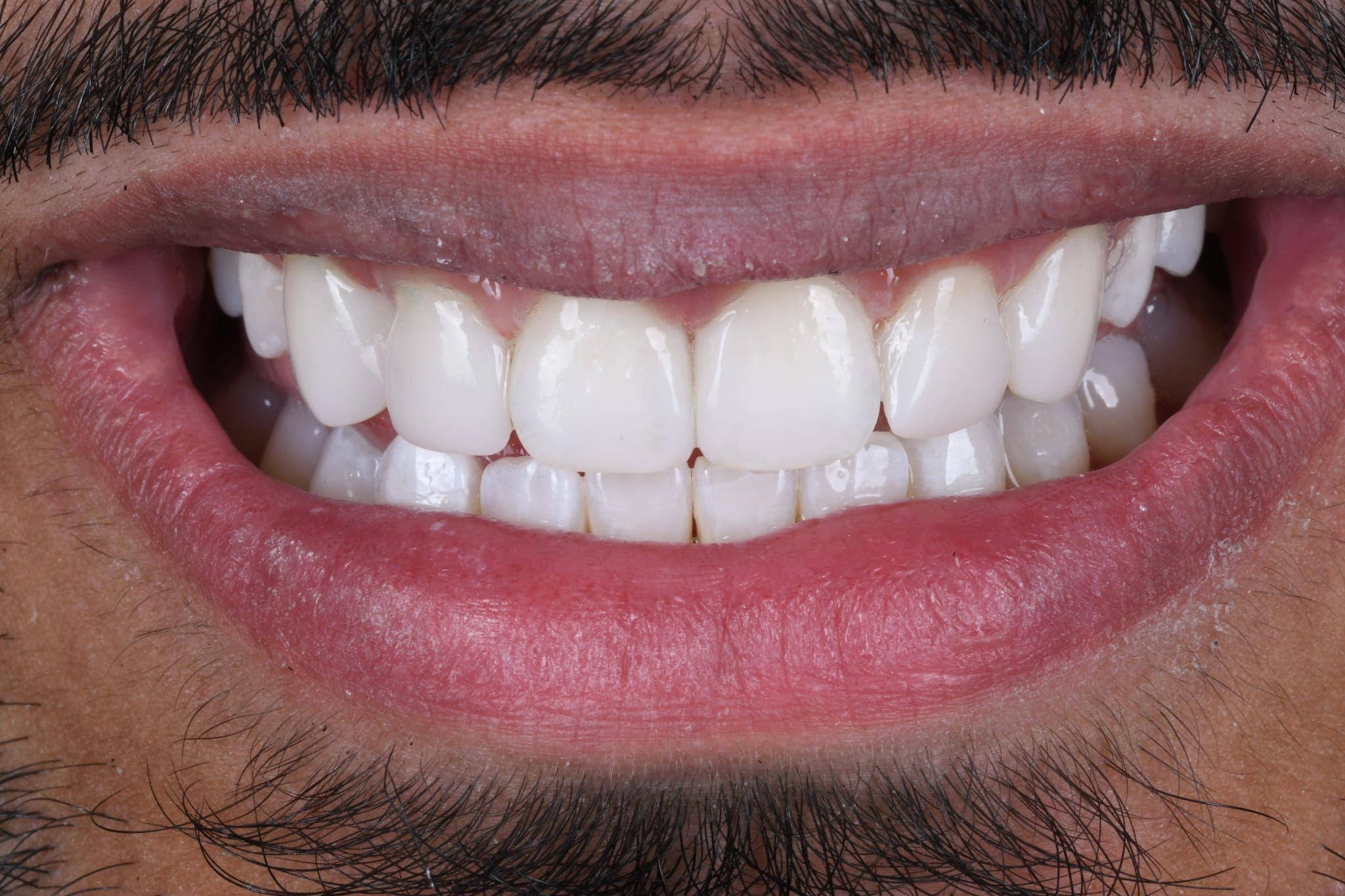 Gap Closure — Confidence Restored — after
